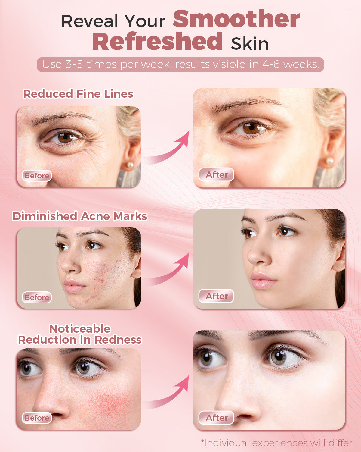 Red Light Therapy Mask for Face with Remote