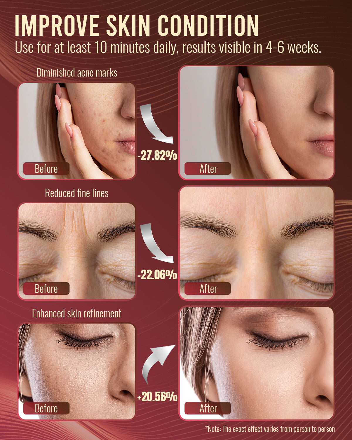 LED Red Light Mask for Skin Care Treatment with Controller