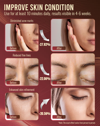 LED Red Light Mask for Skin Care Treatment with Controller